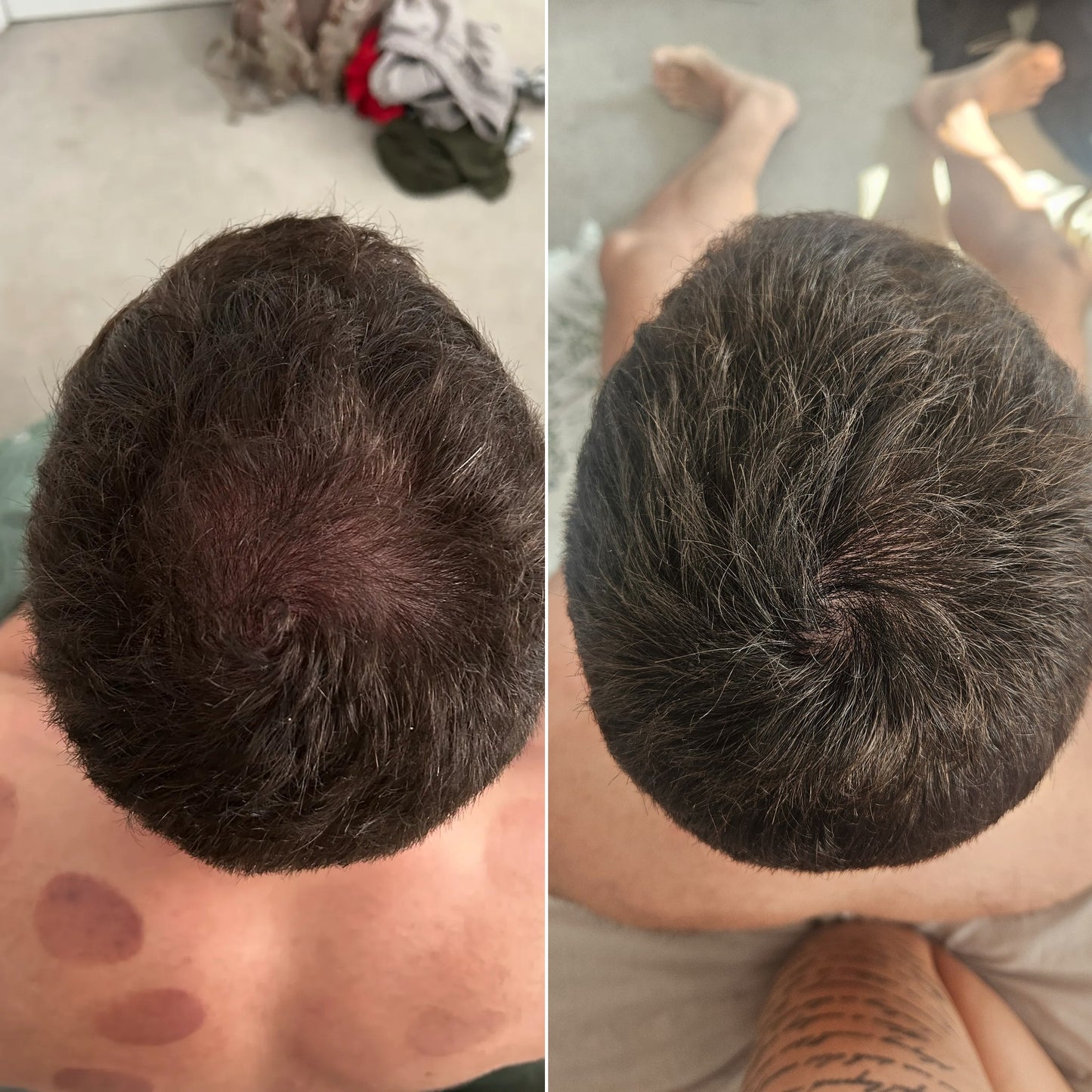 BAIR Copper Complex™ — Advanced Hair Growth & Strength Formula